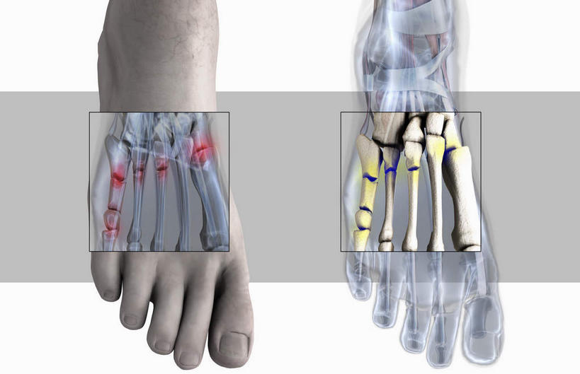 动脉,静脉,骨骼,关节,无人,横图,插画,室内,特写,白天,白色背景,正面,数码,科技,静物,阴影,网络,医学,骨头,高光,几何,计算机图形,合成,图画,画,模型,人体,电脑合成图,数码合成图,骨架,生物学,漫画,生理学,写实,具体,具象,腓骨,跗骨,胫骨,趾骨,半身,彩图