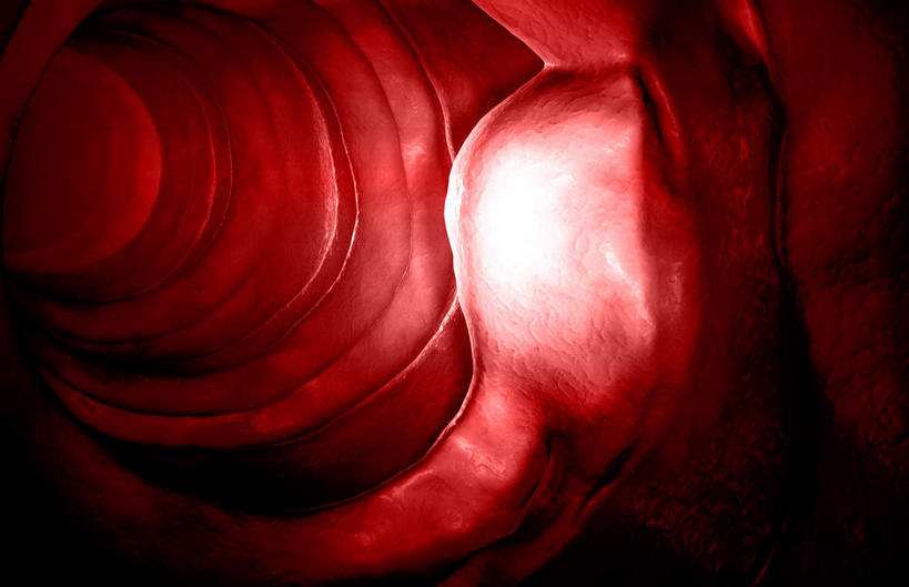 无人,横图,插画,室内,特写,白天,正面,数码,分子,科技,微生物,静物,阴影,黑色背景,网络,医学,高光,几何,计算机图形,合成,图画,画,生物,人体,电脑合成图,数码合成图,医疗,病毒,生物学,漫画,癌症,癌细胞,生理学,写实,具体,具象,白血病,寄生,生命体,血癌,肿瘤细胞,彩图