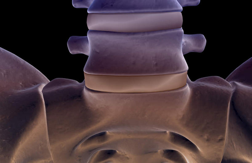 脊髓,骨骼,无人,横图,x光片,室内,白天,正面,数码,科技,阴影,黑色背景,辐射,科学,网络,医学,骨头,高光,几何,计算机图形,合成,电脑合成图,数码合成图,骨架,医疗,科学技术,x射线,x光,写实,具体,具象,腰椎,脊柱,彩图,电磁波,电磁辐射