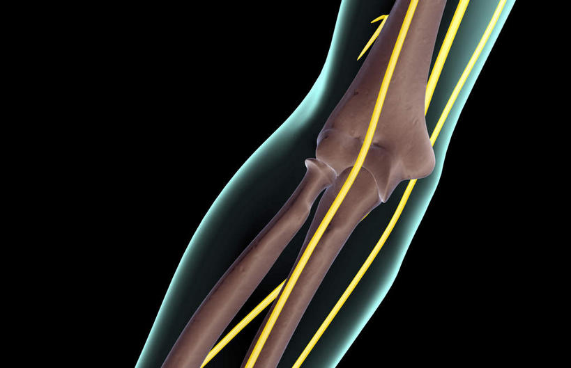 神经,动脉,静脉,骨骼,无人,竖图,插画,x光片,室内,特写,白天,正面,数码,科技,静物,阴影,黑色背景,辐射,科学,网络,医学,骨头,高光,几何,计算机图形,合成,图画,画,黄色,红色,绿色,模型,人体,电脑合成图,数码合成图,骨架,医疗,生物学,科学技术,x射线,x光,漫画,生理学,写实,具体,具象,肱骨,桡骨,肘骨,半身,彩图,神经系统,电磁波,电磁辐射