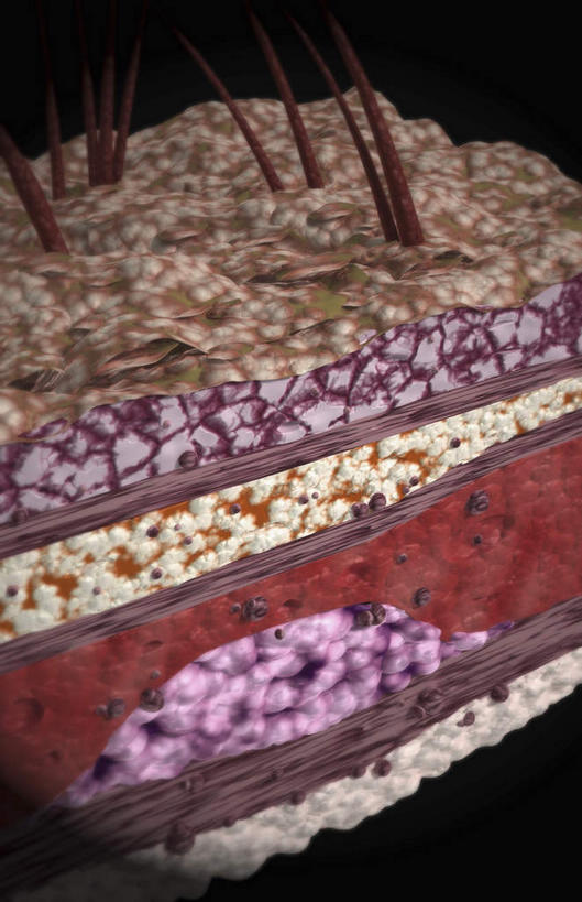 头发,无人,竖图,插画,室内,白天,正面,数码,科技,阴影,黑色背景,微小,网络,细菌,医学,高光,几何,计算机图形,合成,图画,画,动物,电脑合成图,数码合成图,组织,生物学,漫画,真皮,病菌,生理学,写实,具体,具象,传染,寄生,毛囊,彩图,微弱