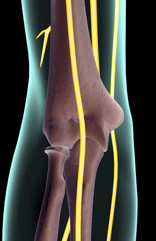 神经,动脉,静脉,骨骼,无人,竖图,插画,x光片,室内,特写,白天,正面,数码,科技,静物,阴影,黑色背景,辐射,科学,网络,医学,线条,支架,骨头,高光,几何,计算机图形,合成,图画,画,黄色,蓝色,模型,人体,轮廓,电脑合成图,数码合成图,骨架,医疗,生物学,科学技术,x射线,筋脉,x光,漫画,生理学,写实,具体,具象,手肘,肘部,彩图,电磁波,电磁辐射