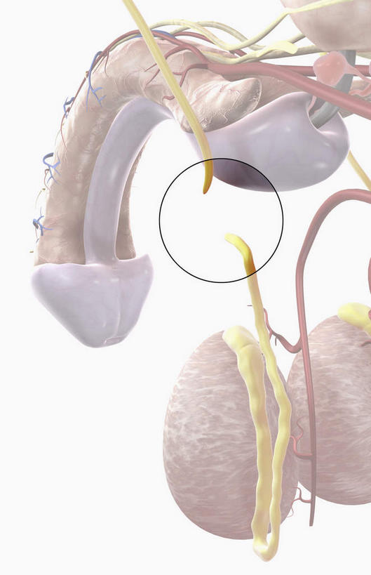 动脉,静脉,膀胱,睾丸,阴囊,无人,竖图,插画,室内,特写,白天,白色背景,正面,数码,科技,静物,阴影,网络,医学,高光,几何,计算机图形,合成,图画,画,模型,人体,电脑合成图,数码合成图,手术,生物学,漫画,泌尿系统,前列腺,生理学,写实,具体,具象,结扎,输精管,彩图,生殖器官