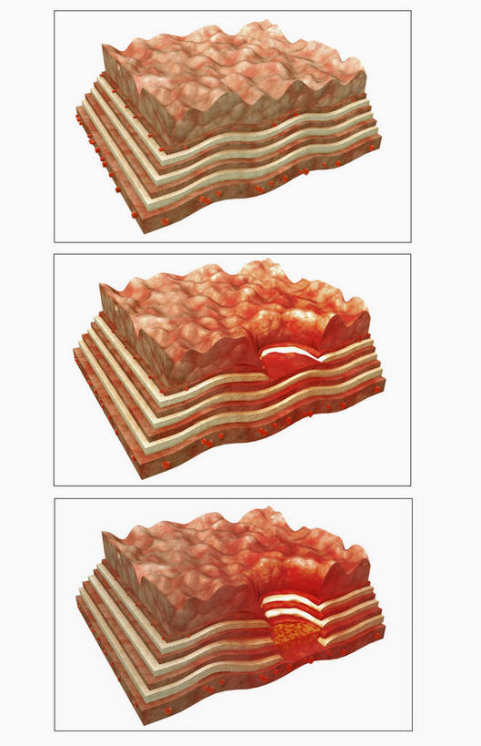 腹部,动脉,静脉,无人,竖图,室内,白天,白色背景,正面,数码,科技,静物,阴影,网络,医学,高光,几何,计算机图形,合成,模型,人体,电脑合成图,数码合成图,生物学,生理学,写实,具体,具象,浆膜,腹,肚子,彩图,胃溃疡