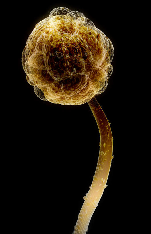 无人,竖图,插画,室内,特写,白天,正面,数码,科技,静物,阴影,黑色背景,网络,细菌,医学,高光,几何,计算机图形,合成,图画,画,人体,电脑合成图,数码合成图,疾病,生物学,漫画,霉菌,生理学,写实,具体,具象,彩图