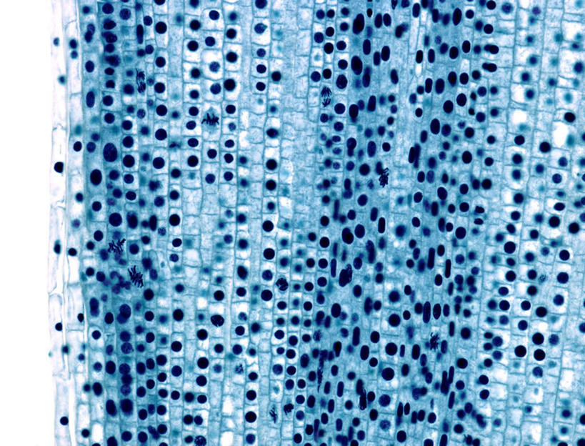 无人,横图,室内,白天,正面,仪器,蔬菜,洋葱,许多,检查,朦胧,模糊,新鲜,反射,分析,光束,科学,颗粒,显微镜,食品,很多,食物,排列,蓝色,观察,清晰,探索,摄影,有机食品,绿色食品,放大,观看,仔细,杂乱,透镜,混乱,凸透镜,聚焦,关注,光学,清楚,摆列,有丝分裂,紊乱,芜杂,竖直,圆葱,洋葱头,球葱,彩图,拍摄,布列,分列