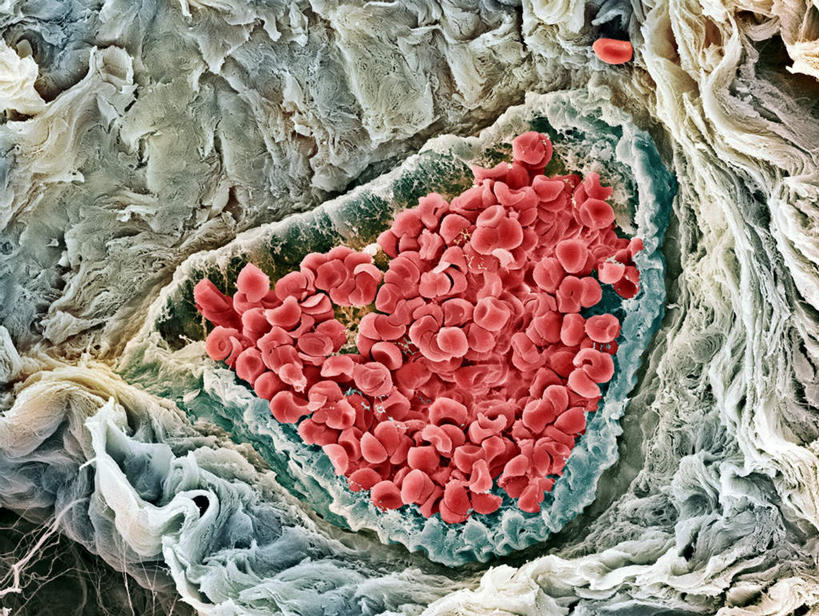 无人,横图,室内,白天,正面,红色,病毒,甲型流感病毒,流感病毒,A型流感病毒,彩图