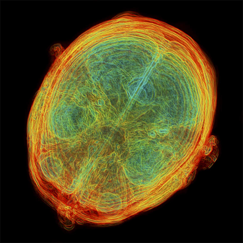 动脉,静脉,无人,交叉,竖图,室内,特写,白天,正面,数码,科技,静物,大脑,连接,阴影,黑色背景,网状,组合,网络,医学,网,高光,几何,计算机图形,合成,交错,模型,人体,链接,交织,电脑合成图,数码合成图,生物学,人体器官,器官,拼接,拼凑,沟壑,小脑,脑干,生理学,写实,具体,具象,拼合,凑集,聚合,撮合,链结,大脑皮层,端脑,沟,灰质,回,间脑,解剖学,彩图