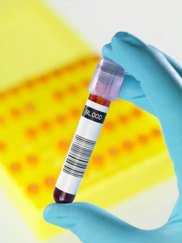 西方人,一个人,医生,捏,竖图,俯视,室内,特写,白天,安全,电子,实验,仪器,杯子,欧洲,欧洲人,仅一个年轻女性,仅一个女性,仅一个人,握,朦胧,模糊,研究,透明,分析,信息,化学,测试,英文,标签,标志,符号,试管,数字,文字,字符,字母,防护,拿,捏着,拿着,标识,玻璃制品,玻璃瓶,瓶子,手套,医护人员,医疗人员,器皿,血液,握着,英文字母,保护,条形码,编码,保险,条码,计量,鲜血,玻璃仪器,试验耗材,实验用品,保全,周全,安稳,安定,防护手套,平安,年轻女性,女人,女性,白种人,大夫,玻璃杯,半身,彩图,高角度拍摄,商业