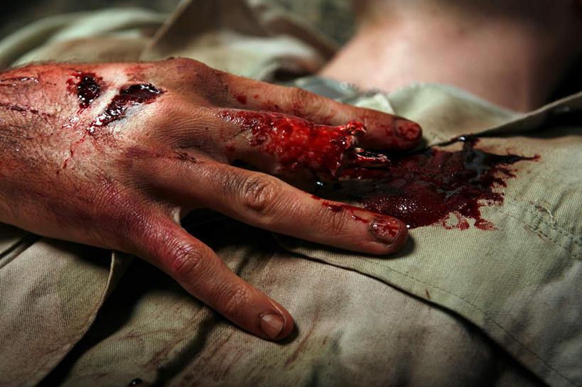 西方人,手,一个人,医院,横图,室内,白天,正面,兴奋,热情,欧洲,欧洲人,仅一个男性,仅一个人,阴影,破碎,反射,血,影子,开放,仅一个年轻男性,红色,健康,温暖,手部,手指,奔放,断裂,活力,积极,激情,朝气,暖色,吉祥,破裂,生命,受伤,饱满,摧毁,医疗机构,革命,热烈,赤色,充实,斗志,喜气,主动,男人,男性,年轻男性,白种人,半身,彩图,欢乐,病院,诊所