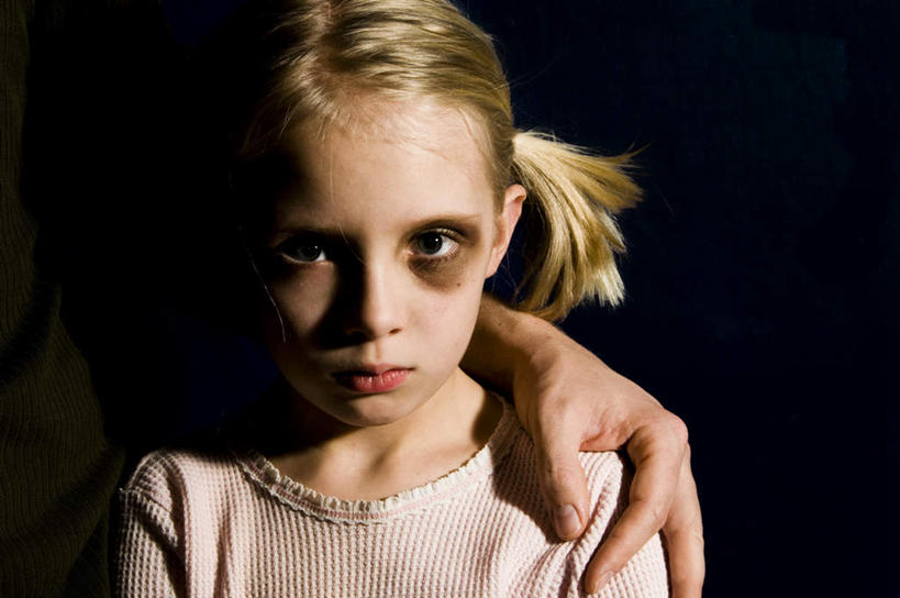 西方人,儿童,脸,头,脸颊,头发,两个人,家庭,父亲,女儿,站,横图,室内,白天,正面,纯洁,欧洲,欧洲人,阴影,服装,反射,影子,注视,休闲装,小孩,衣服,观察,看,站着,休闲,温暖,温馨,父女,一家人,辫子,休闲服,金色,父爱,可爱,童年,童趣,搭,服饰,观看,和睦,察看,搭着,关注,受伤,童真,烂漫,无邪,天真,男人,男性,年轻男性,女孩,白种人,孩子,年轻人,头部,脸部,脸蛋,面部,站立,半身,彩图,融洽,淤青,女生