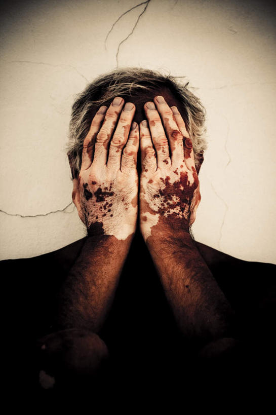 西方人,脸,头,脸颊,一个人,站,举,哭,竖图,室内,特写,白天,正面,欧洲,欧洲人,仅一个男性,仅一个人,缝隙,裂缝,裂痕,墙,裸露,墙壁,墙面,托,站着,仅一个老年男性,遮,遮掩,掩盖,遮挡,裸,皮肤病,遮盖,掩饰,老年男性,男人,男性,白种人,头部,脸部,脸蛋,面部,举起,举手,举着,向上举,向上伸,向上托,站立,半身,彩图,哭泣,哭啼