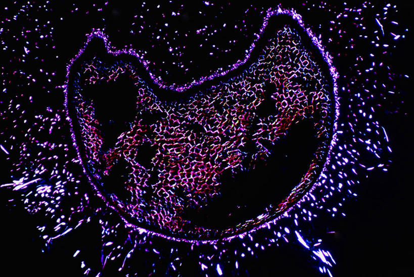 内脏,动脉,静脉,无人,横图,室内,特写,白天,正面,微距,神秘,仪器,微生物,阴影,黑色背景,检查,反射,分析,科学,医学,细胞,显微镜,影子,紫色,观察,清晰,探索,人体,放大,观看,仔细,透镜,生物学,人体器官,优美,凸透镜,聚焦,庄重,器官,高贵,关注,消极,光学,清楚,结肠,冷色,显微图片,自然科学,博物学,生物科学,孤寂,彩图,微距摄影,奢华