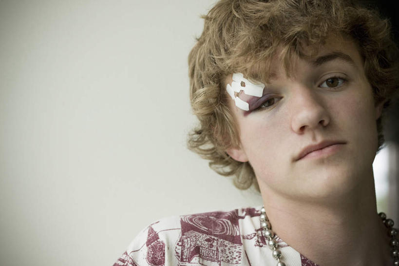 西方人,儿童,脸,头,脸颊,头发,一个人,站,横图,室内,特写,白天,正面,纯洁,欧洲,欧洲人,仅一个男性,仅一个人,阴影,服装,反射,纱布,影子,棕色,注视,休闲装,肩膀,小孩,衣服,观察,看,站着,仅一个小孩,休闲,休闲服,可爱,童年,童趣,治疗,服饰,观看,固定,察看,医疗,关注,受伤,童真,烂漫,无邪,止血,天真,男孩,男人,男性,白种人,孩子,头部,卷发,脸部,脸蛋,面部,绷带,站立,半身,彩图,短发,淤青,男生