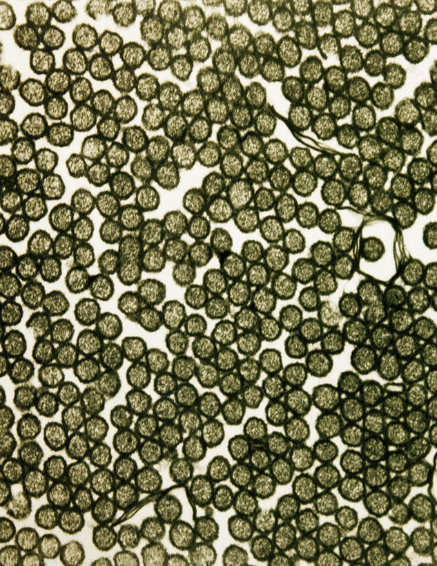 喉咙,无人,竖图,俯视,室内,特写,白天,仪器,微生物,检查,反射,分析,科学,医学,细胞,显微镜,观察,粘液,清晰,探索,放大,观看,仔细,透镜,生物学,凸透镜,聚焦,关注,黏液,神经元,光学,清楚,神经细胞,彩图,高角度拍摄