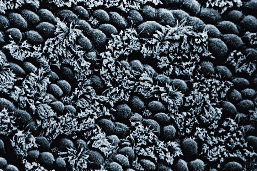 喉咙,气管,无人,横图,俯视,室内,特写,白天,仪器,微生物,检查,反射,分析,科学,医学,纹路,纹理,细胞,显微镜,灰色,观察,清晰,探索,放大,观看,仔细,透镜,生物学,凸透镜,聚焦,关注,神经元,肌理,光学,清楚,神经细胞,彩图,高角度拍摄