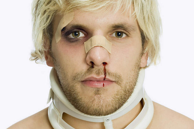 西方人,脸,头,脸颊,一个人,横图,室内,特写,白天,白色背景,正面,欧洲,欧洲人,仅一个男性,仅一个人,注视,肩膀,仅一个年轻男性,医疗用品,观察,看,血液,治疗,摄影,影棚,观看,察看,医疗,医疗设备,关注,胶布,受伤,颈托,止血,男人,男性,年轻男性,白种人,头部,脸部,脸蛋,面部,绷带,创可贴,半身,彩图,影棚拍摄,拍摄