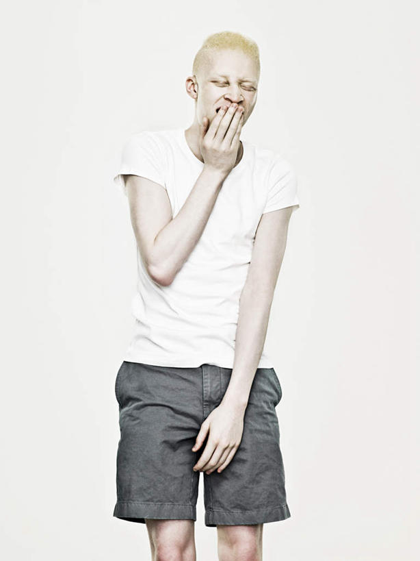 西方人,一个人,站,闭眼,竖图,室内,白天,白色背景,正面,欧洲,非洲,黑人,欧洲人,仅一个男性,仅一个人,服装,休闲装,仅一个年轻男性,衣服,打哈欠,站着,张嘴,休闲,生病,休闲服,摄影,服饰,影棚,张大嘴巴,抱病,白化病,男人,男性,年轻男性,非洲人,张开嘴,闭眼睛,闭着眼,闭着眼睛,站立,半身,彩图,影棚拍摄,拍摄