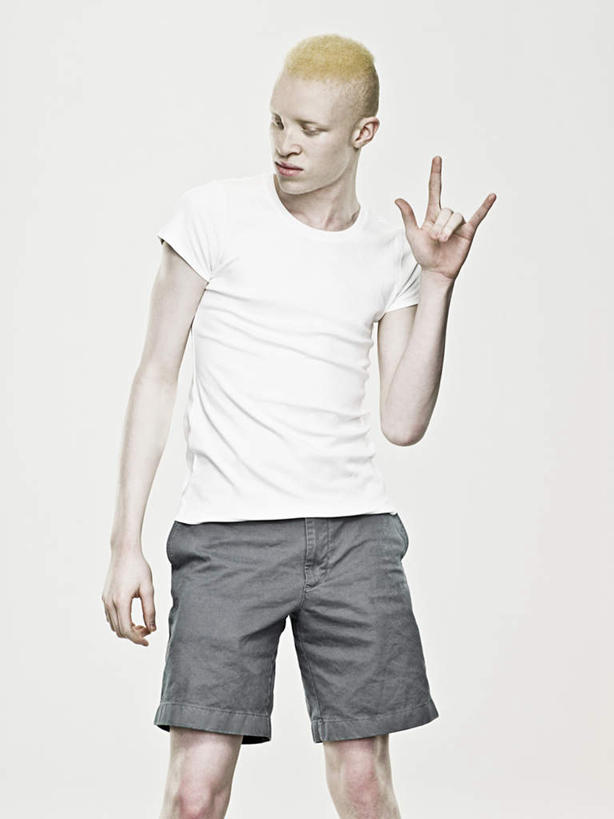 西方人,小拇指,一个人,站,竖图,室内,白天,白色背景,正面,欧洲,非洲,黑人,欧洲人,仅一个男性,仅一个人,服装,扭头,注视,休闲装,仅一个年轻男性,衣服,白色,观察,看,手势,站着,转头,休闲,生病,休闲服,竖,摄影,服饰,影棚,观看,翘,察看,食指,关注,示爱,抱病,爱你,白化病,男人,男性,年轻男性,非洲人,站立,半身,彩图,影棚拍摄,拍摄