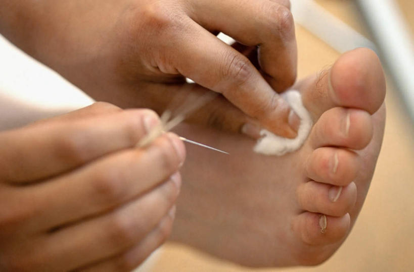 西方人,手,腿部,脚,脚趾,脚趾甲,腿,两个人,医生,躺,横图,俯视,室内,特写,白天,农作物,欧洲,欧洲人,双手,握,阴影,朦胧,模糊,柔软,反射,医学,影子,棉花,拿,拿着,光脚,文化,纺织,医护人员,医疗人员,健康,温暖,赤脚,手部,棉花球,治疗,握着,保健,经络,纤维,医疗,穴位,中国文化,针灸,调和,中医,医治,柔和,疏通,暖和,灸法,针法,中医学,卧着,男人,男性,女人,女性,中年男性,中年女性,白种人,脚指甲,大夫,躺着,卧,半身,彩图,高角度拍摄,传统文化