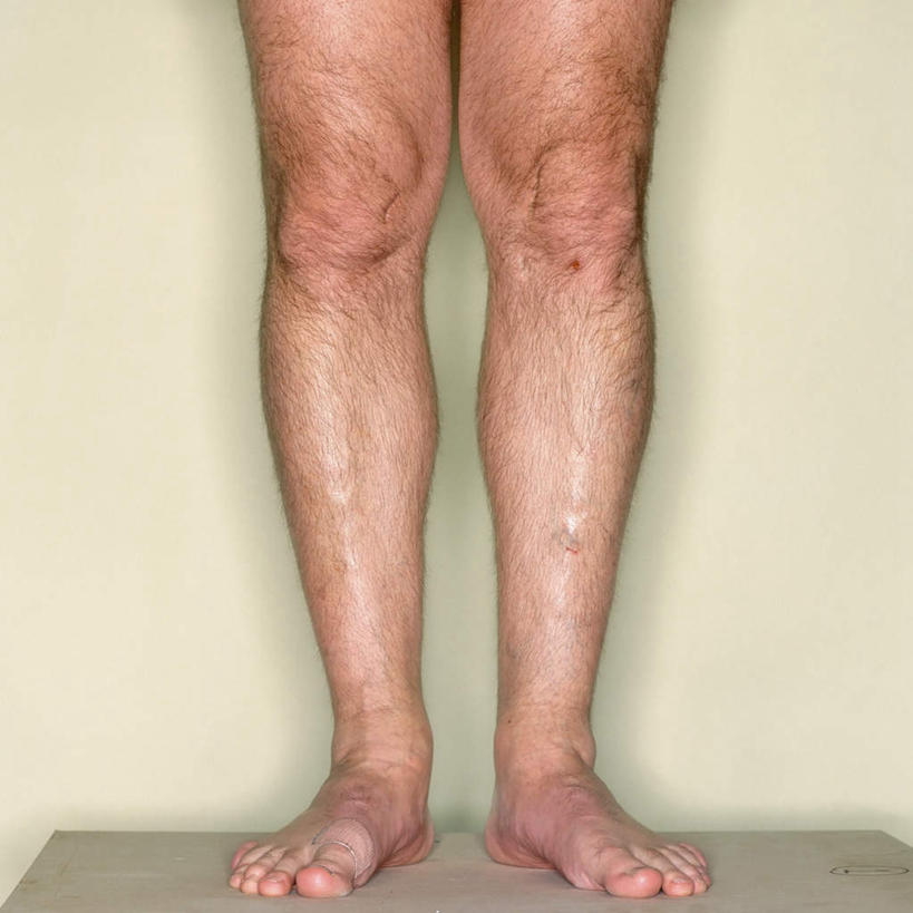 西方人,腿部,脚,脚趾,脚趾甲,腿,一个人,站,方图,室内,白天,正面,欧洲,欧洲人,仅一个男性,仅一个人,仅一个中年男性,阴影,黄色背景,反射,影子,光脚,裸露,站着,赤脚,摄影,影棚,裸,腿毛,男人,男性,中年男性,白种人,脚指甲,站立,半身,彩图,影棚拍摄,拍摄