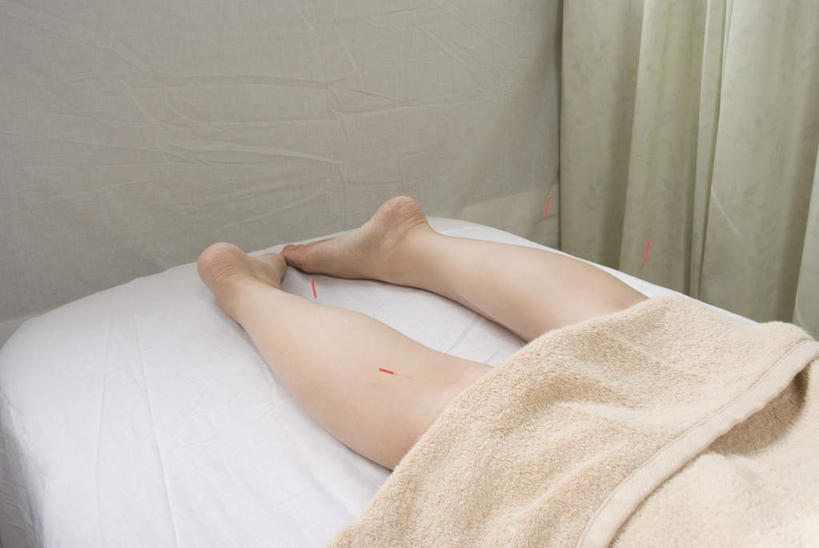 东方人,腿部,脚,脚趾,脚趾甲,腿,一个人,病人,医院,横图,俯视,室内,白天,床,亚洲,仅一个年轻女性,仅一个女性,仅一个人,阴影,光线,纺织物,影子,床单,黄种人,裸露,毛巾,趴着,清洁,单人床,保暖,裸,针灸,透气,防水,医疗机构,针灸针,储水,耐磨,吸水,年轻女性,女人,女性,亚洲人,脚指甲,患者,就医者,趴,半身,彩图,高角度拍摄,病院,诊所