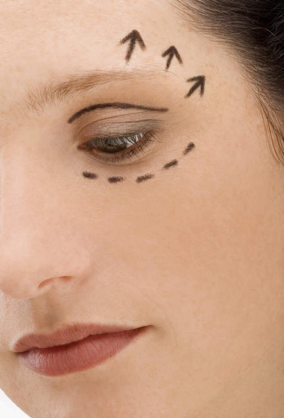 西方人,脸,头,眼睛,脸颊,眉毛,睫毛,一个人,竖图,室内,特写,白天,正面,欧洲,欧洲人,瞳孔,仅一个年轻女性,仅一个女性,仅一个人,注视,方向,标记,箭头,黑色,观察,看,眼部,观看,察看,手术,指向,关注,整形,簇,年轻女性,女人,女性,白种人,头部,睫,脸部,脸蛋,眉,面部,眼,眼睫毛,眼眉,半身,彩图,外科手术,医疗美容外科手术,整形手术,眼眉毛