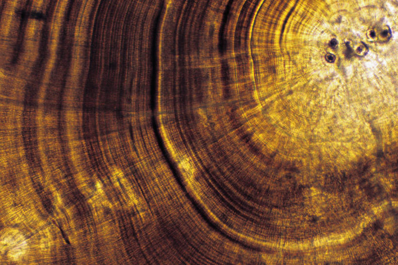 耳朵,骨骼,无人,横图,白天,技术,盘绕,研究,环绕,围绕,圆形,图形,圆,圆环,同心圆,几何,环抱,鱼类,标记,戒指,比较,摄影,缭绕,放大,温度,环形,数学,耳,耳部,彩图,几何图形,平面图形