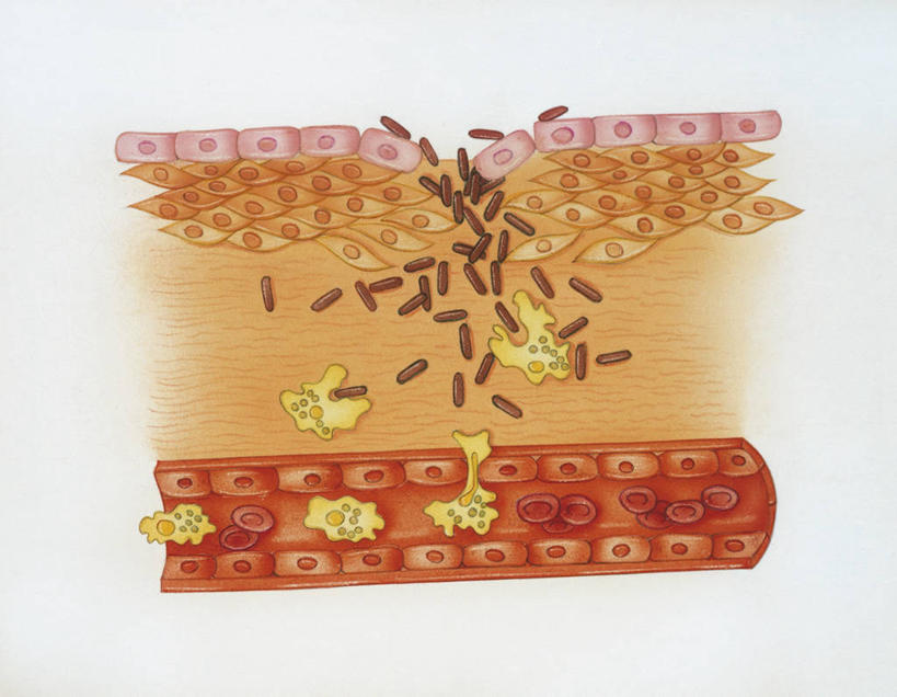 无人,横图,插画,白色背景,数码,科技,阴影,科学,网络,细胞,高光,几何,计算机图形,合成,图画,画,白色,生病,人体,落下,电脑合成图,数码合成图,疾病,生物学,合成图,进入,横截面,漫画,生理学,写实,具体,具象,炎症,人体结构,微生物学,彩图