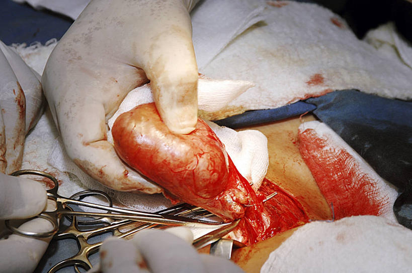 手,两个人,医院,横图,室内,特写,白天,安全,苏丹,镊子,防护,拿着,手套,纸巾,血液,摄影,保护,协助,部分,手术,伤口,手术室,准确,保险,外科医生,保全,周全,安稳,安定,防护手套,甲状腺,技能,平安,彩图