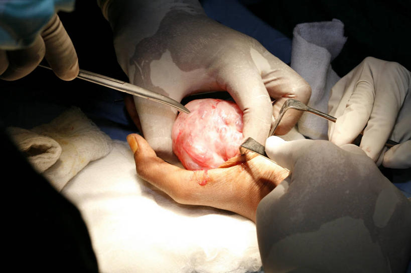 成年人,手,四个人,横图,室内,特写,安全,纱布,防护,拿着,手套,血液,摄影,保护,部分,手术,手术室,专心,肿瘤,解剖刀,保险,切断,手术台,医疗工具,外科医生,保全,周全,安稳,安定,防护手套,平安,男人,彩图