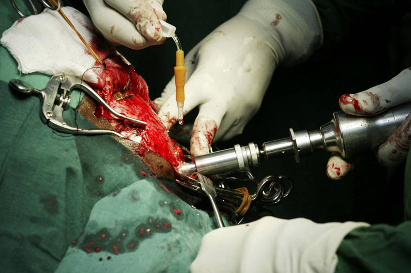 头,手,两个人,医院,横图,室内,特写,白天,安全,苏丹,镊子,防护,拿着,手套,血液,摄影,皮肤,保护,部分,手术,伤口,准确,解剖刀,保险,外科医生,保全,周全,安稳,安定,防护手套,技能,平安,头部,彩图