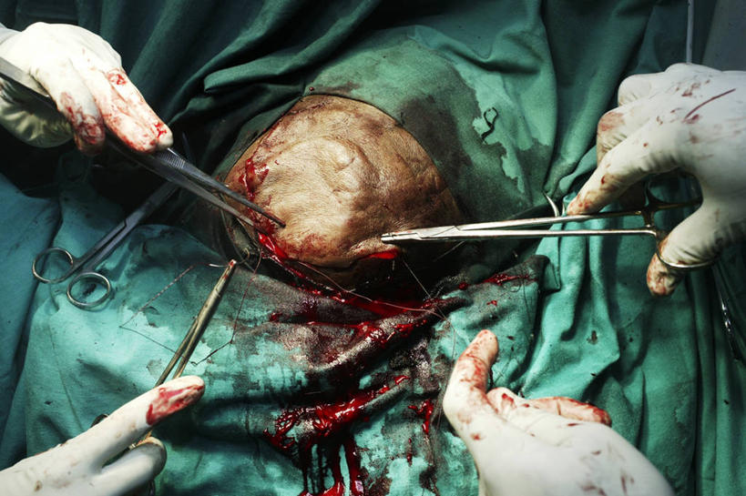 头,手,一个人,医院,横图,室内,特写,白天,安全,苏丹,镊子,防护,拿着,手套,血液,摄影,皮肤,保护,部分,手术,伤口,准确,拼接,解剖刀,保险,外科医生,保全,周全,安稳,安定,缝合,防护手套,技能,平安,头部,彩图,缝线