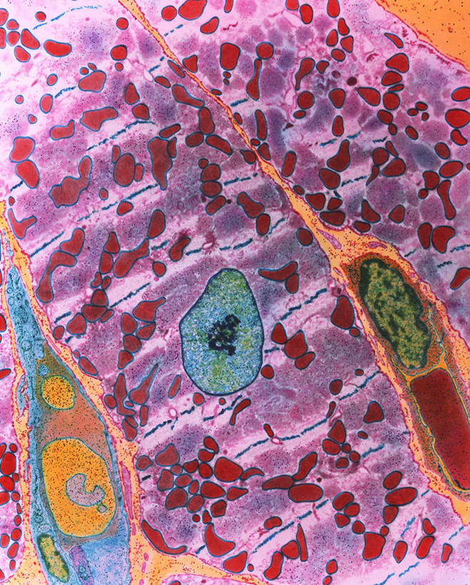 无人,竖图,俯视,室内,特写,白天,仪器,微生物,许多,检查,反射,分析,科学,血球,医学,细胞,显微镜,很多,黄色,红色,蓝色,绿色,紫色,观察,清晰,探索,放大,观看,仔细,透镜,生物学,血细胞,凸透镜,聚焦,关注,收缩,光学,清楚,显微图片,心肌,彩图,高角度拍摄,透射电子显微镜,肌肉细胞,肌细胞,舒张,肌肉组织,基本组织,心肌细胞